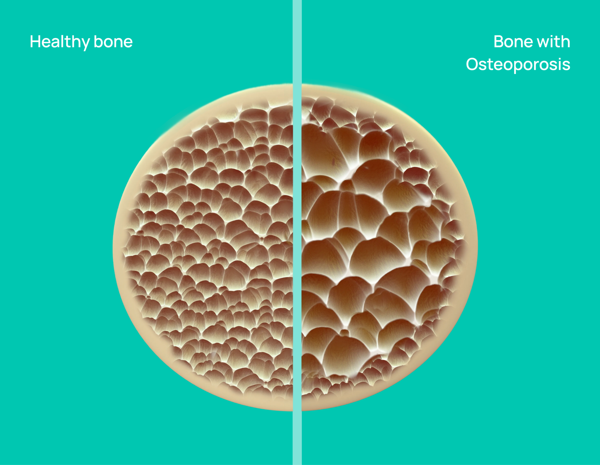 Enoby Device About ENOBY™ - Enoby Strengthen and protect your bones from fracture...